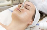peeling volto medicina estetica presso studio anfosso grassi